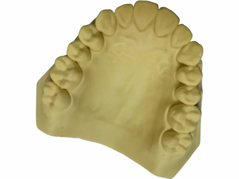 High Precision Dental Stone Plaster Model for Dental Laboratory